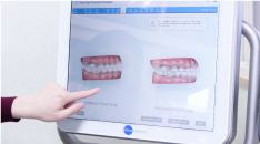 カウンセリング