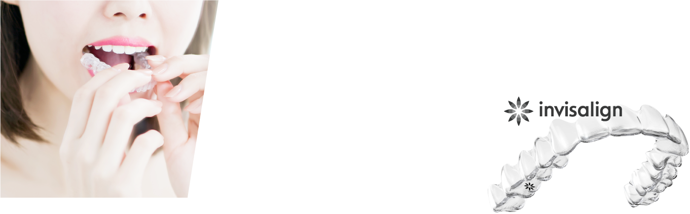 インビザライン