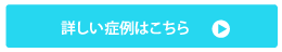 症例はこちら