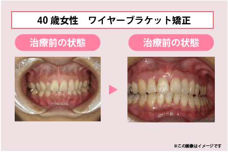 症例イメージ画像