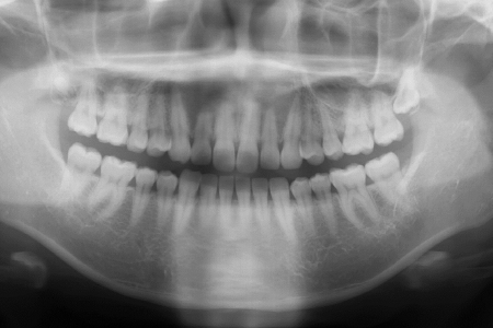 コンプレックスが解消
