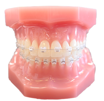 マイオブレーストレーナー